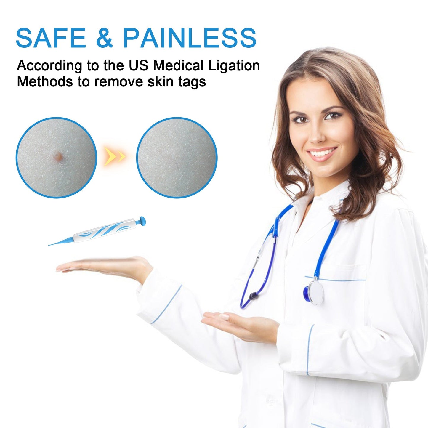 Skin Tag and Mole Removal Tool Pen